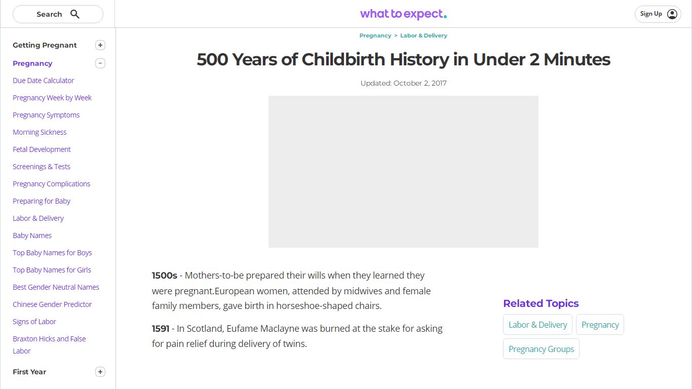 500 Years of Childbirth History - What to Expect